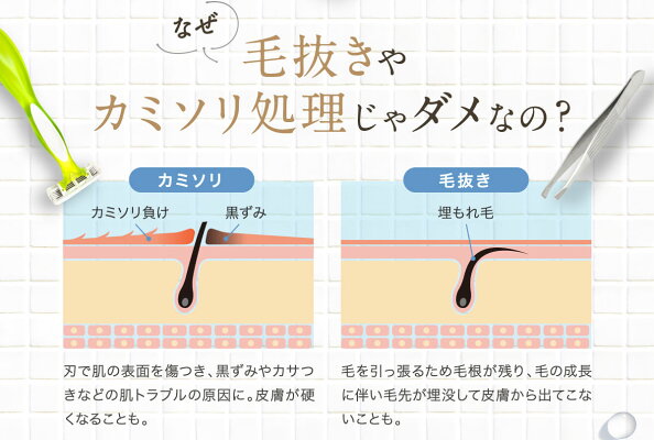 除毛クリーム アンダーヘア 除毛 Subevi クリーム Vio 大容量2g 低刺激 敏感肌用 ムダ毛処理 剛毛 送料無料 除毛剤 クリーム 女性 男性 子供用 レディース メンズ キッズ 女 男 敏感肌 低刺激 今だけお得な3 1個セット 2 980円もお得 除毛クリーム 敏感肌 除毛クリーム アンダーヘア 除毛 Subevi クリーム Vio 大容量2g 低刺激 敏感肌用 ムダ毛処理 剛毛 送料無料 除毛剤 クリーム 女性 男性 子供用 レディース メンズ キッズ 女 男 敏感肌 低刺激 今だけお得な3 1個セット 2 980円もお得 除毛クリーム 敏感肌