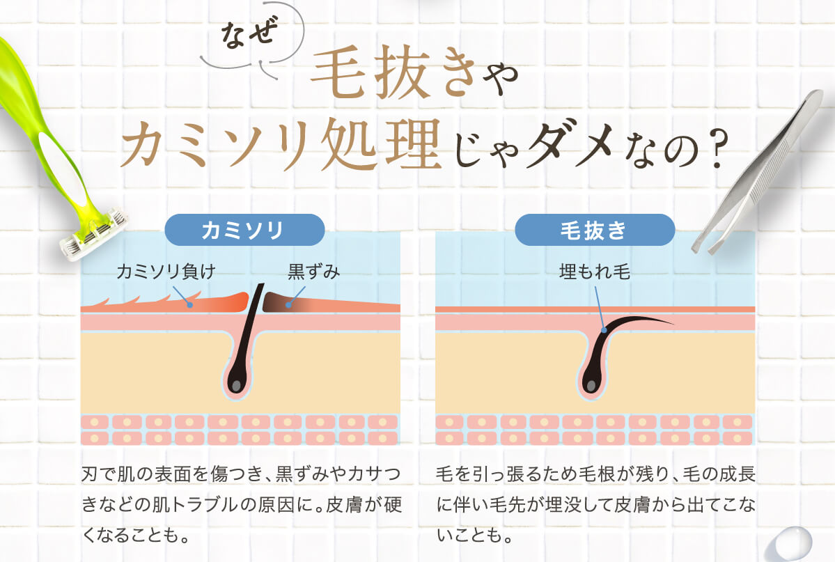 除毛クリーム アンダーヘア 除毛 Subevi クリーム Vio 大容量2g 低刺激 敏感肌用 ムダ毛処理 剛毛 送料無料 除毛剤 クリーム 女性 男性 子供用 レディース メンズ キッズ 女 男 敏感肌 低刺激 今だけお得な3 1個セット 2 980円もお得 除毛クリーム 敏感肌