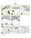 【20本入】エキスパンタイTC型20　高さ：80mm　キャップ色：ブラック 3