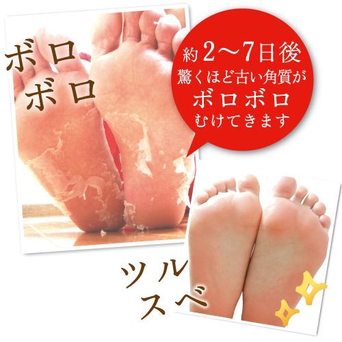 ベビーフット イージーパック SPT60分タイプ ピーリング 角質 削らない角質ケア 足裏 babyfoot フットケア かかと[Z]