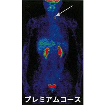 P1 プレミアムコース [ PET-CT 頭部MRI 骨盤腔MR 超音波検査 腫瘍マーカー がん チェック 子宮 卵巣 膀胱 前立腺 腹部 すい臓 腎臓 消化管 悪性リンパ腫 スクリーニング検査 ]