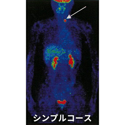 18位! 口コミ数「0件」評価「0」P3 シンプルコース　【 PET-CT検査 発見しにくい 早期 小さながん 高確率 見つける 画期的 検査方法 無症状 早期発見 がん検診 ･･･ 