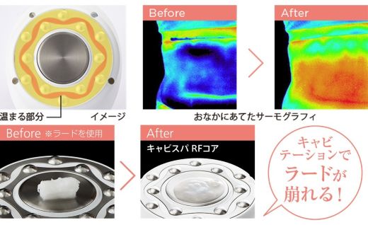 【ふるさと納税】 美容家電 ヤーマン 美容器 ボディケア YA-MAN ｜ キャビテーション フェイスケア 超音波 EMS ラジオ波 RF 家庭用 防水 お風呂 エステ プレゼント ギフト キャビスパRFコアPLUS HRF51B 宮城県 加美町 sl00003