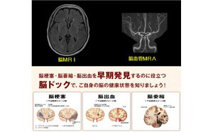 【ふるさと納税】脳ドック（Aプラン） 脳梗塞・脳腫瘍・脳出血の早期発見【まつだ整形外科クリニック】