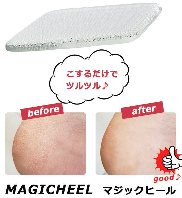 シャインネイル マジックヒール ２点セット ネイル 最大71 Offクーポン 爪みがき ガラス製 かかとケア 2点セット 繰り返し使用可能 水洗い可