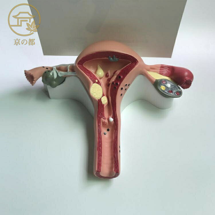 女性生殖器 卵巣模型 標本 模型 女性子宮 人体模型 子宮 女性卵巣 生殖器 子宮モデ...