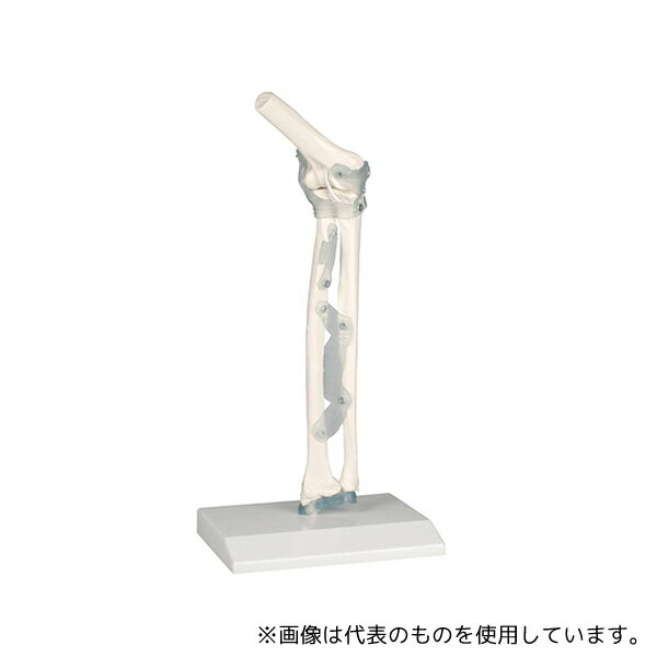 Erler-Zimmer 4556 肘関節モデル