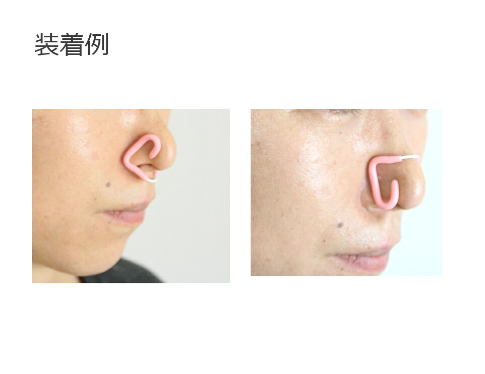 �ڿ���Ѿ�ʪ�ۡ�2093��LAXTO(�饯����)���󥯥��ѥΡ�������åס�ɡ���[NOSE CLIP/�����ॢ�������꡼]