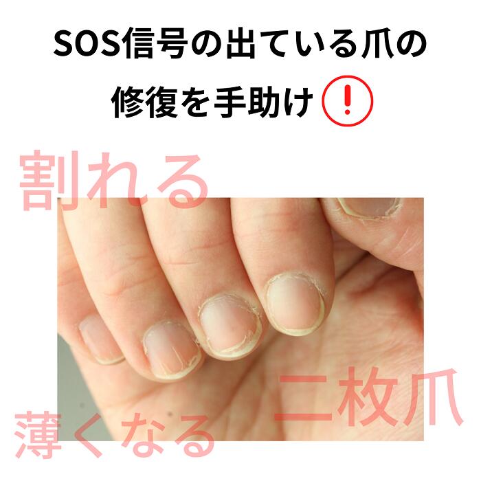 【期間限定クーポン配布中】 国内正規品 OPI オーピーアイ ネイルエンビー 15ml 育爪 爪強化剤 爪割れ 薄い爪 二枚爪 ベースコート ネイルケア221 222 223 オリジナル original