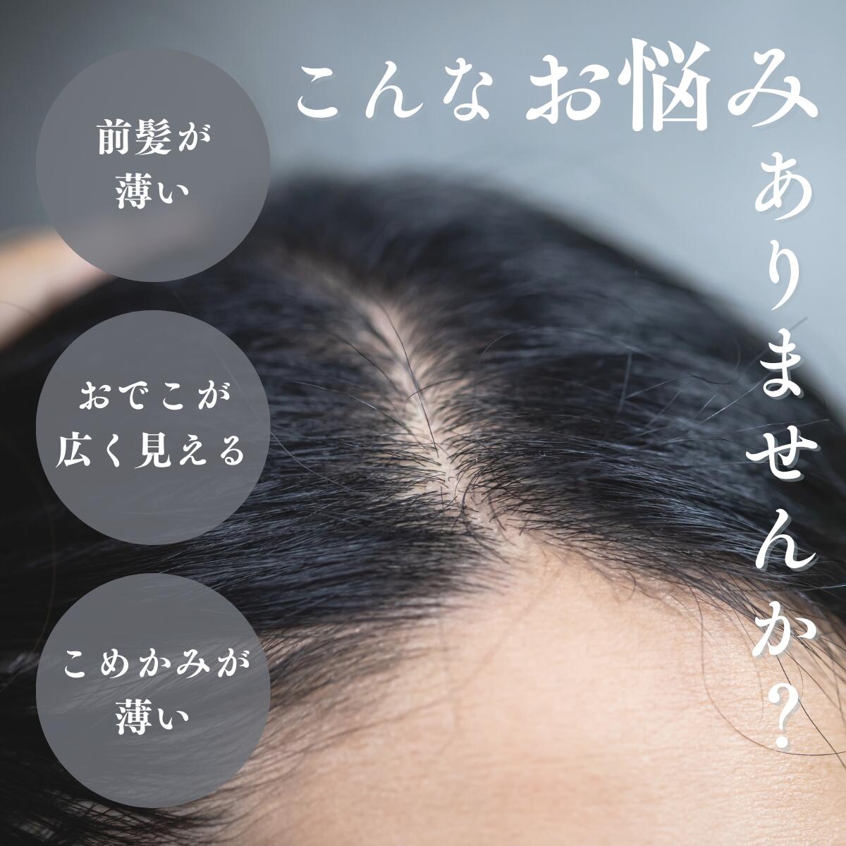 前髪が薄くなってきた方へ　自然な量感に1.5倍増量｜シースルー前髪ウィッグ（人毛100％）【5×6cm】｜ちょい足しウィッグシリーズ 人毛100％ 前髪が薄い 割れる おでこ広いお悩みに 自然にカバーできる軽量前髪ウィッグ 美容師監修 フラッティス 2