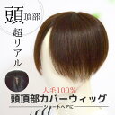 人毛100％ 頭頂部カバーウィッグ 円形15cm☆ ヘアピース 人毛 部分ウィッグ リアルスキン つむじ付き ウィッグ 自然 前髪 女性 部分かつら 白髪隠し 分け目 トップピース 医療用部分ウィッグ