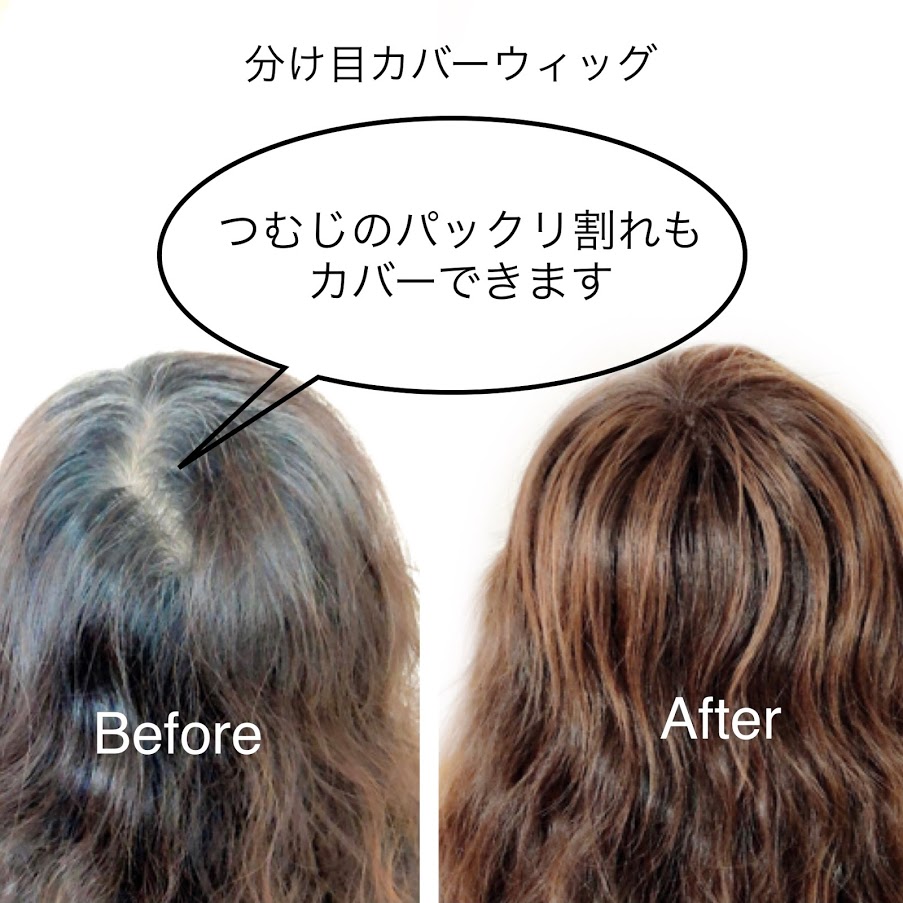 正規品 人毛100 分け目カバーウィッグ ロングヘアー用 つむじ 人毛 人工皮膚 レミーヘアー 薄毛かくし 白髪かくし トップピース ヘアピース 部分ウィッグ ウイッグ かつら 頭頂部カバー 増毛 ポイントウィッグ 抗がん剤 産後脱毛 円形脱毛 最新人気 正規品 人毛100 分け目カバーウィッグ ロングヘアー用 つむじ 人毛 人工皮膚 レミーヘアー 薄毛かくし 白髪かくし トップピース ヘアピース 部分ウィッグ ウイッグ かつら 頭頂部カバー 増毛 ポイントウィッグ 抗がん剤 産後脱毛 円形脱毛 最新人気