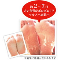 �ʰ������٥ӡ��եå� ���������ѥå�SPT 30ʬ������ (M������) 27cm�ޤ��б��Υͥ��ݥ�����2��