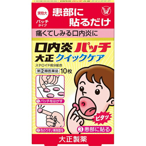 ★【第(2)類医薬品】口内炎パッチ 大正クイックケア 10枚 [セルフメディケーション税制対象商品]