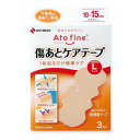 アトファイン 傷あとケアテープ Lサイズ 3枚 手術後 傷あとケア 帝王切開 (対応傷あとサイズ 10~15cm)