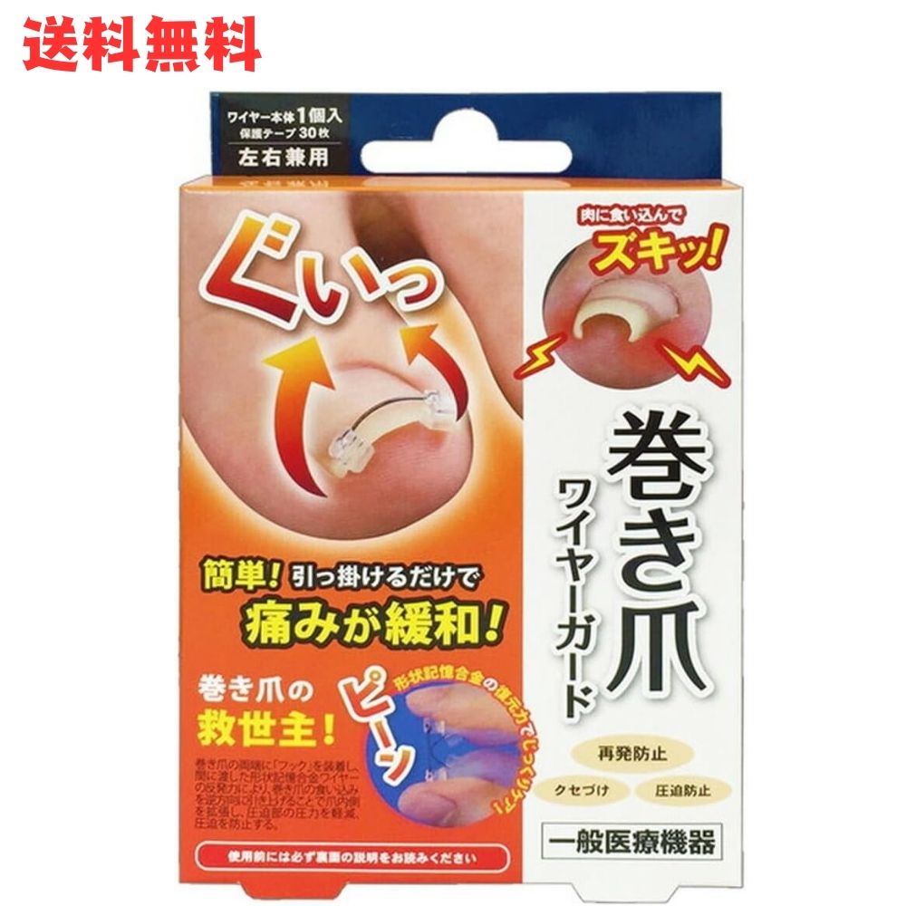 巻き爪 矯正 ワイヤー 一般医療機器 巻き爪ワイヤーガード [選べる1個/2個セット] 形状記憶合金 巻き爪ケア クリップ 矯正器具 自分で 治療 テープ フック 陥入爪 痛み 緩和 改善 足 親指 サイプラス
