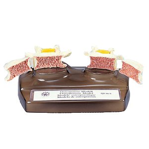 骨粗しょう症模型(SR-326)【smtb-s】 3