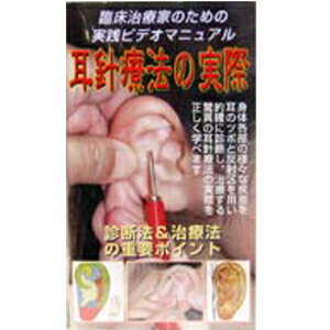 DVD・耳針療法(じしんりょうほう)の実際(SR-454)【smtb-s】