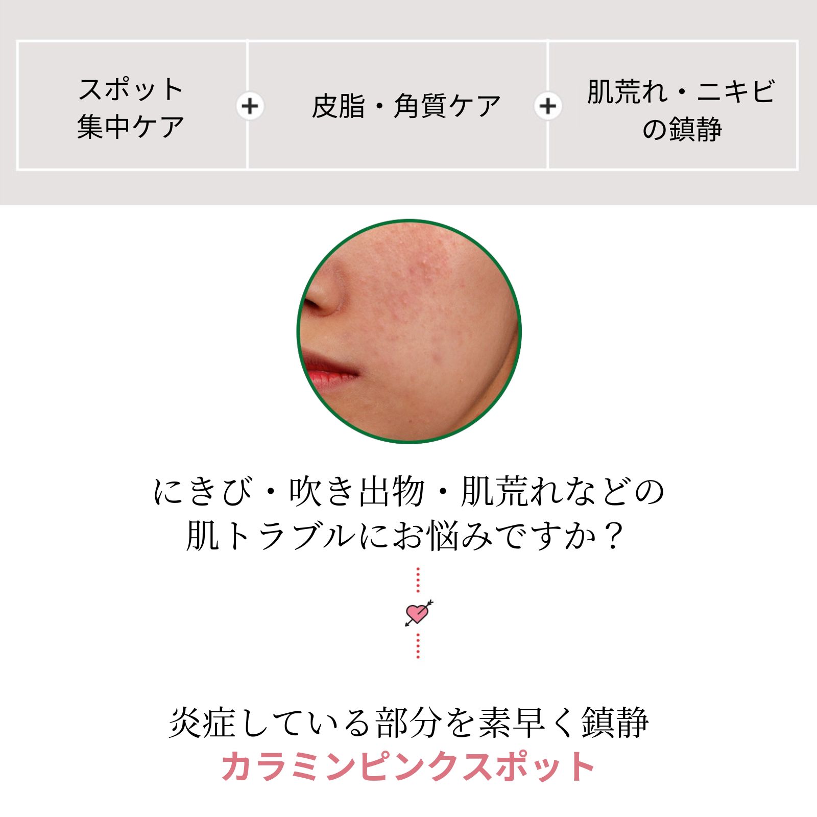 リファイニング C ピンクスポット / The YEON ザヨン 韓国 コスメ 正規品 ニキビケア アクネケア 大人にきび 顔 首 背中 肌荒れ 炎症 集中ケア カラミン成分配合 低刺激 敏感肌 混合肌 オイリー肌 トラブル肌 対策 ケア 鎮静 消炎 保湿 美容 レディース メンズ 韓国製