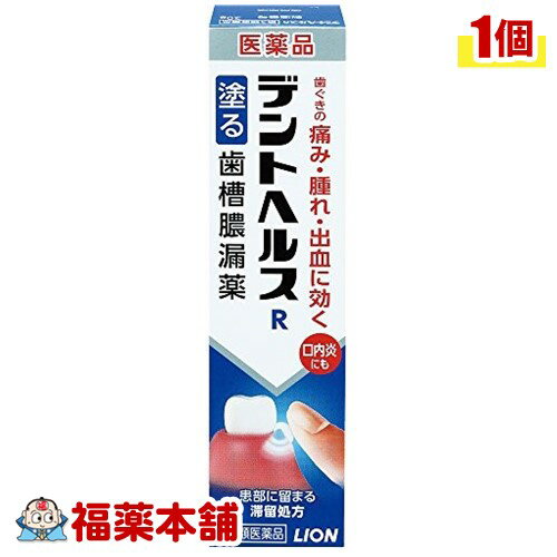 【第3類医薬品】デントヘルスR歯槽膿漏薬 (20g) [ゆうパケット・送料無料]