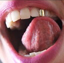 【期間限定DEALポイントバック15%】 ゴールドシングルグリルズ GRILLZ 亜羅亜羅系 アクセサリー メンズ レディース 男女兼用 金歯 イベント 仮装 ...