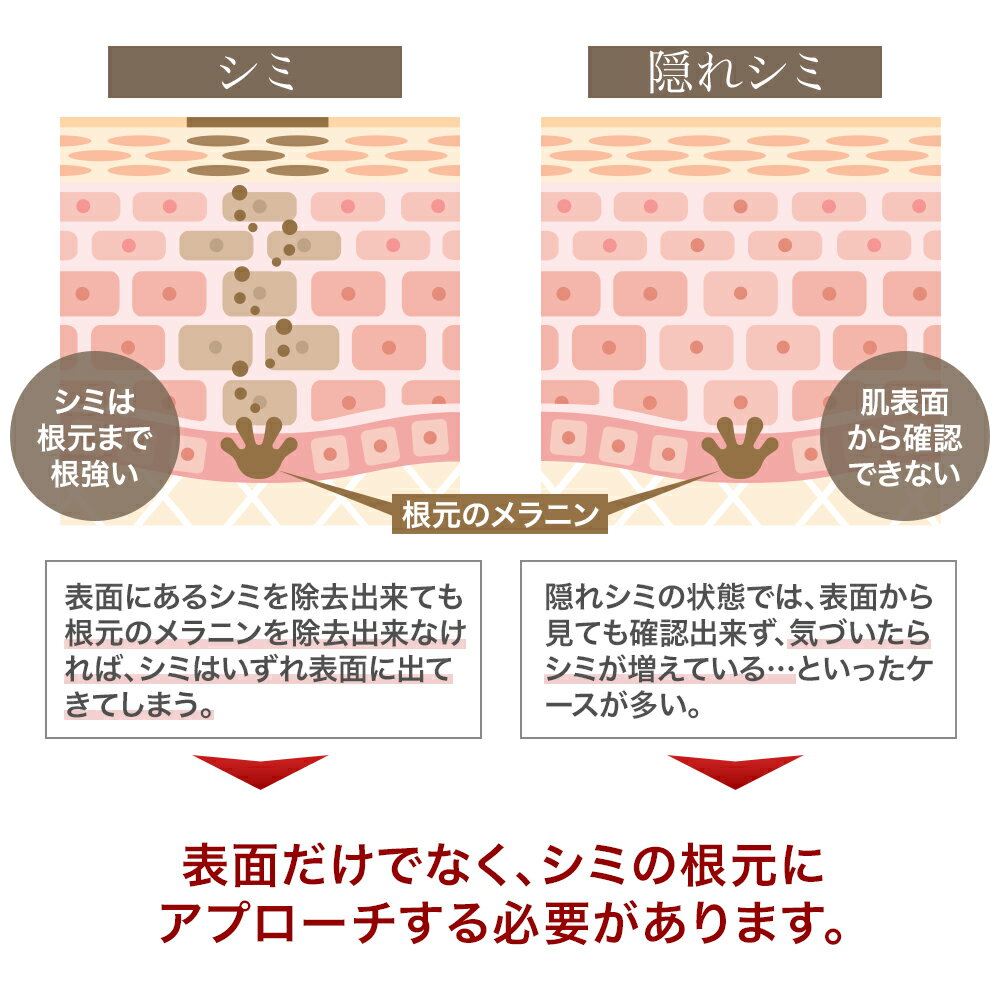 ルミナスホワイト