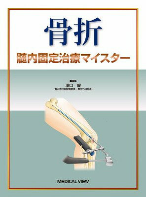  骨折　髄内固定治療マイスター(コッセツ ズイナイコテイチリョウマイスター)