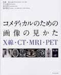 [書籍] コメディカルのための画像の見かた X線・CT・MRI・PET【10 000円以上送料無料】 コメディカルノタメノガゾウノミカタ Xセン・CT・MRI・PET 