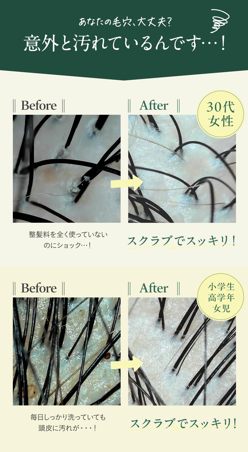 ������20��OFF���ۥإåɥ������ ������� Ƭ�饱�� ������� Ƭ�齭 �˥��� ����󥸥� Ƭ��ޥå����� �إåɥ��� �إ����� ��ȱ �٤��Ĥ� ����KOTONA��Refreshed Scalp Scrub��