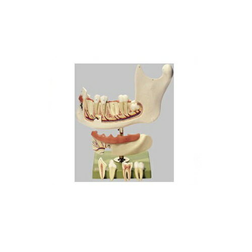 18歳青年の下顎模型 高さ34×幅34×奥行18cm 1.6kg ES4 ソムソ