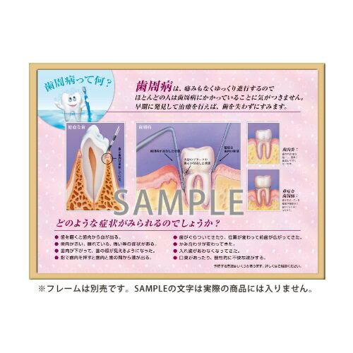 フレームアート 歯周病って何? 453×604mm 1枚入 SmartPractice