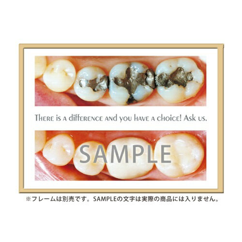 フレームアート Before&After #1 453×604mm 1枚入 SmartPractice