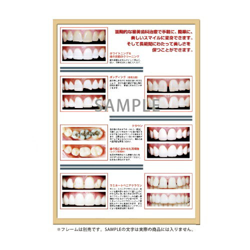 フレームアート Before&After #3 453×604mm 1枚入 SmartPractice