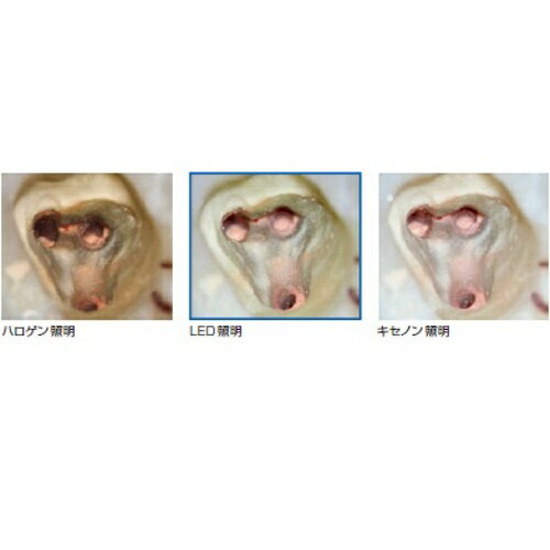 手術顕微鏡 pico MORA フロアスタンド LED ビームPあり バリ GC