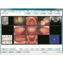 歯科用画像管理ソフトウェア ディンフォネスト3(スタンドアロン)アップグード版 1セット GC