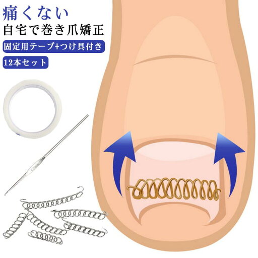 テー 巻き爪矯正グッズ 巻き爪チェーン 12個セット 矯正器具 爪ワイヤー 12個セット 矯正 巻き爪 足の巻き爪 爪切り セルフケア テー 巻き爪矯正グッズ 巻き爪チェーン 12個セット 矯正器具 爪ワイヤー 12個セット 矯正 巻き爪 足の巻き爪 爪切り セルフケア