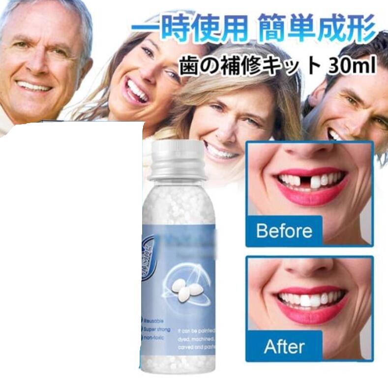 樹脂ビーズ 成形可能 修正 隙間埋め 入れ歯 仮歯 固形接着剤 歯の補修キット 義歯 応急処置 パーティー 歯の補修キット 差し歯 一時的 セルフ 義歯用 穴埋め 材料 歯の修復ツール 変装 小道具 持ち運び 簡単 お湯で変形