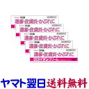 【第(2)類医薬品】ロコイダンクリーム 16g X 5個セット(ロコイドクリームの市販薬) ヒドロコルチゾン クラシエ