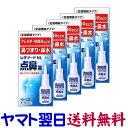 【第2類医薬品】レチナートNL点鼻薬 30mL ×5個セット 花粉症などのアレルギー性鼻炎に