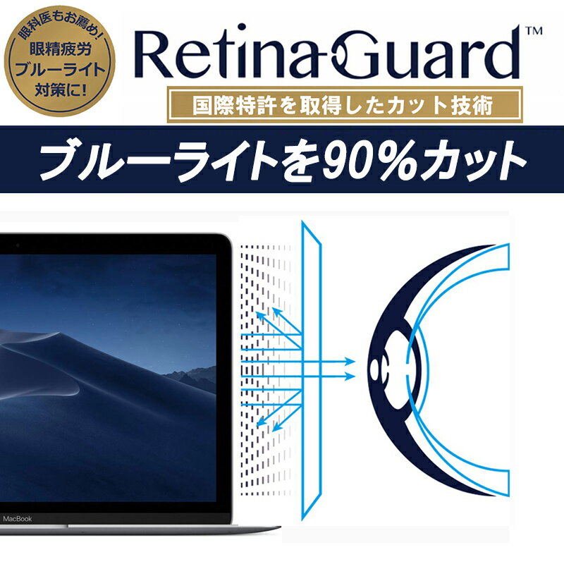 国際特許RetinaGuardiPhone6/6sブルーライト90%カット保護フィルム送料無料液晶保護フィルム保護シート保護シールアイフォンキズ防止カット率No.1