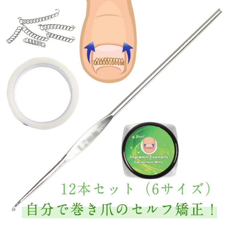 巻き爪チェーン 矯正テープ テープ付き 巻き爪チェーン 爪ワイヤー ガード 矯正 巻きづめ ワイヤー 12個セット 対策 テープ 巻き爪矯正グッズ 靴 巻爪 巻き爪 自宅で治す 足の巻き爪 防止 テーピング サポーター