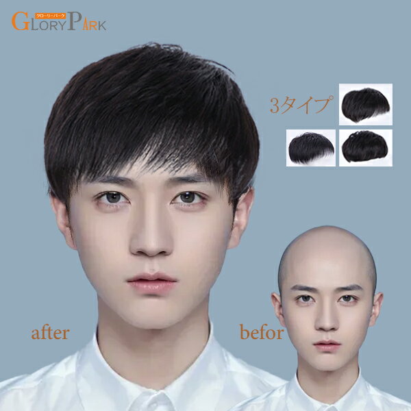 総手植えウィッグ メンズウィッグ男性用 耐熱ウィッグ 自然人毛 3タイプ ブラックインテリウィッグ 日常用 ウィッグ 療用かつらグローリーパーク