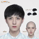 メンズウィッグ 総手植えウィッグ男性用 自然人毛 3タイプ ブラックインテリウィッグ 日常用 ウィッグ 療用かつらグローリーパーク