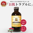 ＼TVで紹介／無添加 ひまし油 ケイシー ジャマイカン ブラックキャスターオイル 118ml 黒ひまし油 ヒマシ油 髪 顔 キャスターオイル カソーダ ひまし油湿布 頭皮 ケア スキンケア ニキビケア ニキビ跡 大人ニキビ シミ取り