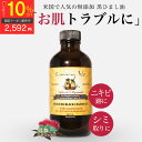 【10％OFFクーポン配布中】＼TVで紹介／無添加オーガニック ひまし油 ケイシー ジャマイカン ブラックキャスターオイル 118ml 有機 黒ひまし油 ヒマシ油 髪 顔 キャスターオイル カソーダ ひまし油湿布 頭皮 ケア スキンケア ニキビケア ニキビ跡 大人ニキビ シミ取り