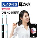 【全品20%OFF】★レビュー特典★カメラ付き耳かき スマホ 耳かき カメラ ライト 子供 LED 耳掃除 イヤースコープ フルHD スマホ 最新版 無線 3.5mm 1296p 耳垢クリーニング みみかき 介護耳かき スマート耳かき カメラ 高画質 内視鏡付き 小型レンズ 耳鏡 Android