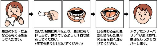 �ڻ�����2������ʡ����������å����� 5g(��������)