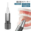 超音波口腔洗浄器 超音波 口腔洗浄器 内視鏡付き 口洗浄 高圧口腔洗浄器 三段階調節 口腔ケア 口内洗浄器 IPX7防水 歯磨き 矯正 歯間 歯垢洗浄 ひとり 一人用 Tpye-C充電 電子版日本語説明書(2)
