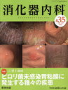 消化器内科（♯35（Vol．5 No．1） 特集：ピロリ菌未感染胃粘膜に発生する種々の疾患