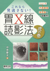 これなら見逃さない!胃X線読影法虎の巻 シェーマ＋内視鏡像＋病理像で一目瞭然!